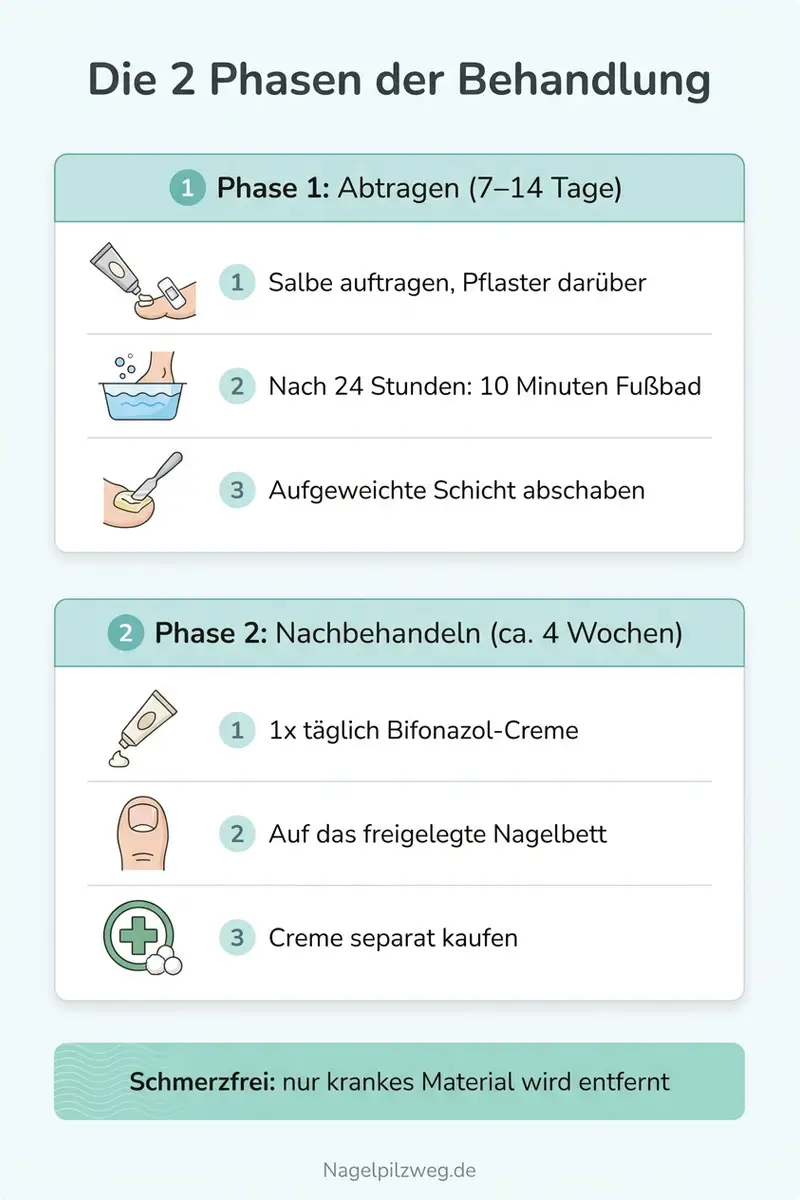 Infografik: Die zwei Phasen der Behandlung mit dem Nagelset