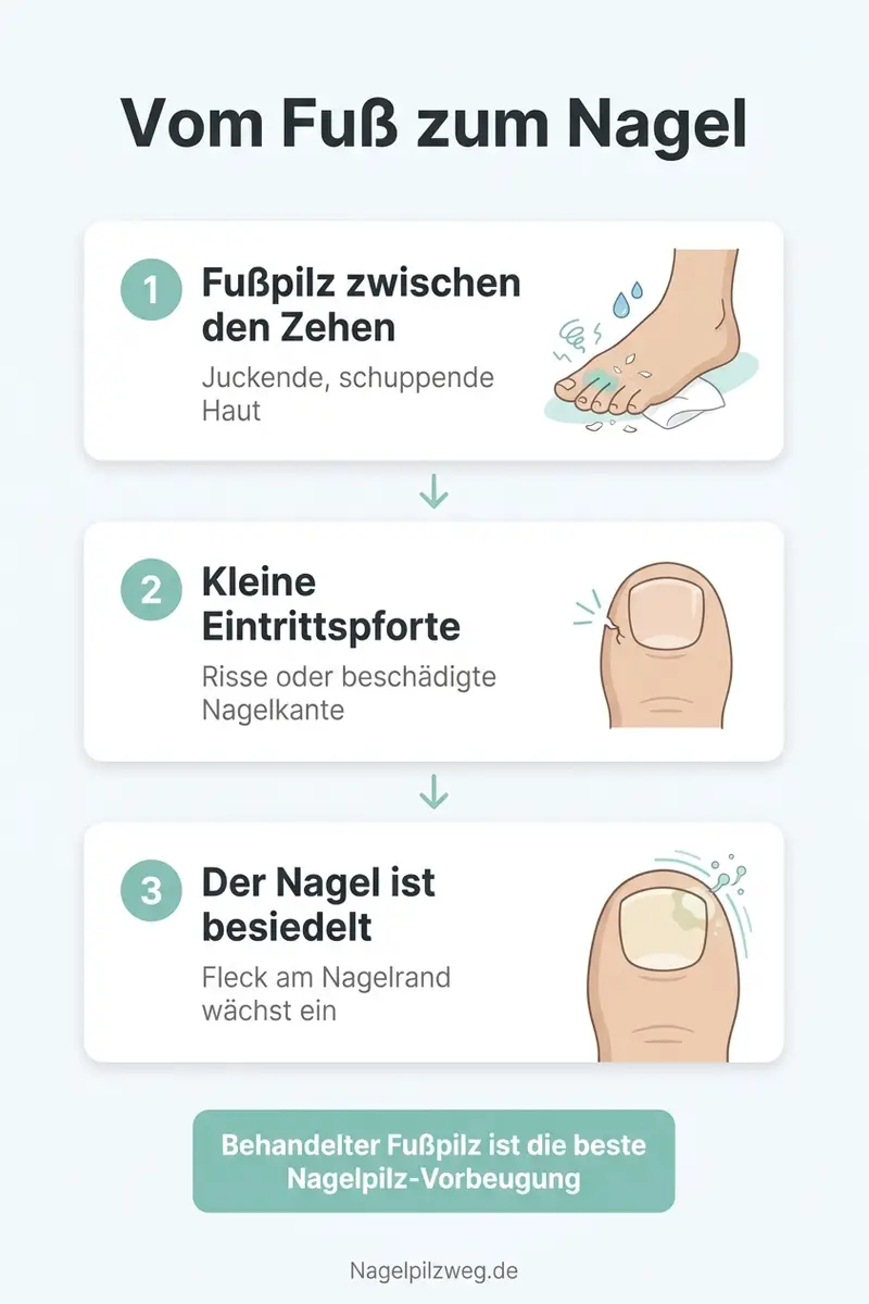 Infografik: Die Ansteckungskette vom Fuß zum Nagel