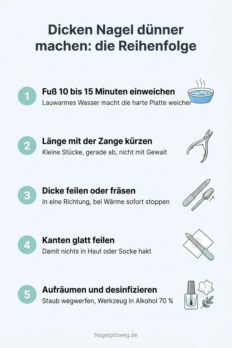 Infografik: Die richtige Reihenfolge beim Ausdünnen eines dicken Nagels