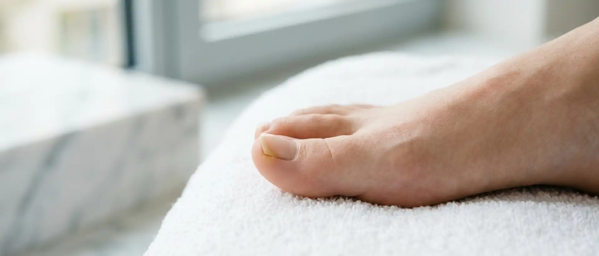 Nagelpilz erkennen: Merkmale und Verwechslungen