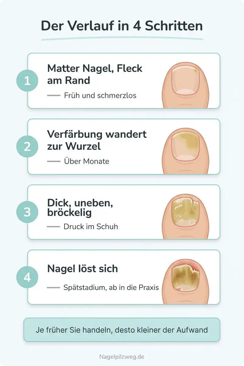 Infografik: Der typische Symptomverlauf von früh bis spät